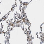 Immunohistochemical staining of human lung shows strong cytoplasmic positivity in macrophages.