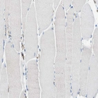 Immunohistochemical staining of human skeletal muscle shows no positivity in myocytes as expected.