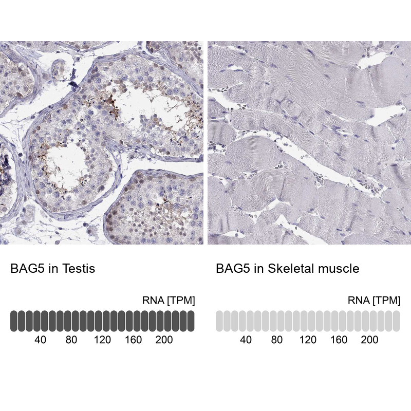 Anti-BAG5 Antibody