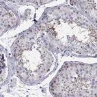 Immunohistochemical staining of human testis shows moderate positivity in cells in seminiferous ducts.