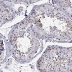 Immunohistochemical staining of human testis shows moderate positivity in cells in seminiferous ducts.