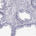 Immunohistochemical staining of human prostate shows very weak cytoplasmic positivity in smooth muscle cells.