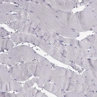 Immunohistochemical staining of human skeletal muscle shows no positivity in myocytes as expected.
