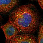 Immunofluorescent staining of human cell line A-431 shows localization to vesicles.
