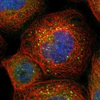 Immunofluorescent staining of human cell line A-431 shows localization to vesicles.