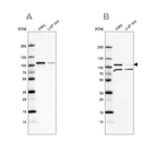 Western blot analysis using Anti-SRPK1 antibody HPA016431 (A) shows similar pattern to independent antibody HPA056486 (B).
