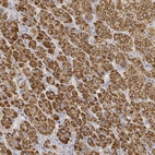 Immunohistochemical staining of adrenal gland shows strong cytoplasmic positivity in cortical cells.