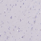 Immunohistochemical staining of human cerebral cortex shows low expression as expected.
