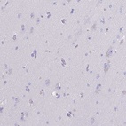 Anti-CYP11A1 Antibody