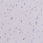 Immunohistochemical staining of human cerebral cortex shows low expression as expected.