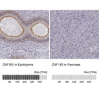 Anti-ZNF185 Antibody