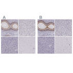 Immunohistochemical staining of human epididymis, liver, pancreas and skeletal muscle using Anti-ZNF185 antibody HPA016438 (A) shows similar protein distribution across tissues to independent antibody HPA000400 (B).