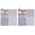 Immunohistochemical staining of human epididymis, liver, pancreas and skeletal muscle using Anti-ZNF185 antibody HPA016438 (A) shows similar protein distribution across tissues to independent antibody HPA000400 (B).