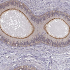 Immunohistochemical staining of human epididymis shows strong membranous positivity in glandular cells.