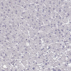 Anti-ZNF185 Antibody