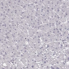 Immunohistochemical staining of human liver shows no positivity in hepatocytes as expected.