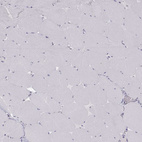 Immunohistochemical staining of human skeletal muscle shows no positivity in myocytes as expected.