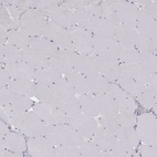 Immunohistochemical staining of human skeletal muscle shows no positivity in myocytes as expected.