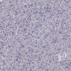 Immunohistochemical staining of human pancreas shows no positivity in exocrine glandular cells as expected.