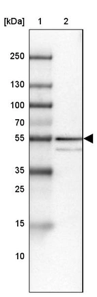 Lane 1: Marker [kDa] 250, 130, 100, 70, 55, 35, 25, 15, 10_br/_Lane 2: Human Liver tissue