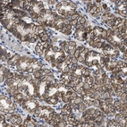 Anti-GHITM Antibody