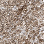 Anti-GPAT4 Antibody