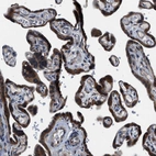 Immunohistochemical staining of human Placenta shows strong cytoplasmic positivity in trophoblastic cells.