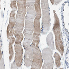 Immunohistochemical staining of human Skeletal muscle shows moderate cytoplasmic positivity in myocytes.