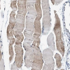 Immunohistochemical staining of human Skeletal muscle shows moderate cytoplasmic positivity in myocytes.