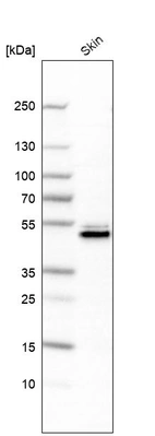 Western blot analysis in human skin tissue.