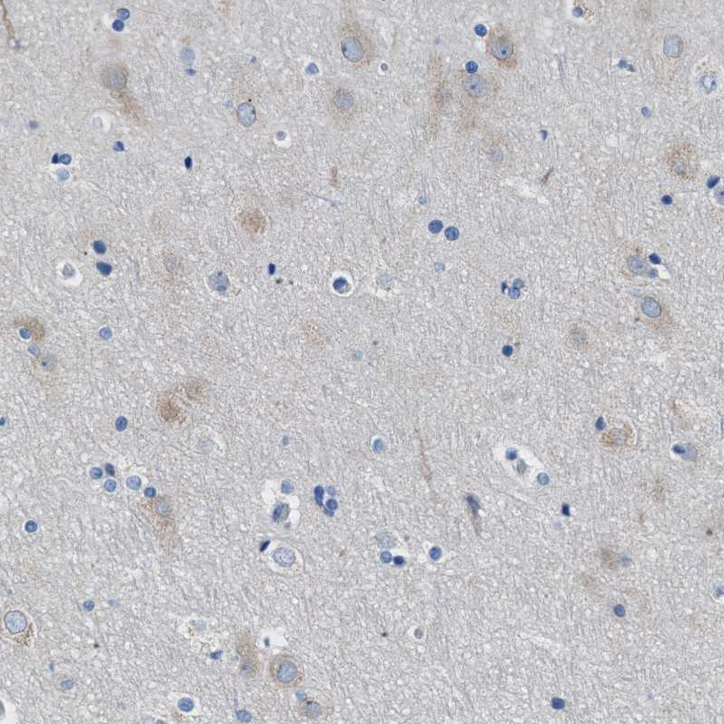 Anti-ITPR1 Antibody