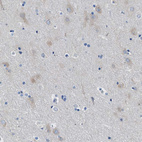Anti-ITPR1 Antibody