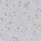 Anti-ITPR1 Antibody