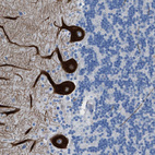 Immunohistochemical staining of human cerebellum shows moderate to strong cytoplasmic positivity in Purkinje cells.