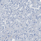 Immunohistochemical staining of human liver shows no positivity in hepatocytes as expected.