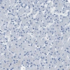 Immunohistochemical staining of human liver shows no positivity in hepatocytes as expected.