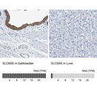 Anti-SLC6A6 Antibody