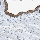Immunohistochemical staining of human Gallbladder shows strong membranous positivity in glandular cells.