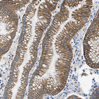 Immunohistochemical staining of human Stomach shows strong membranous positivity in glandular cells.