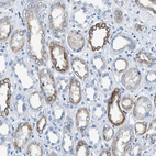 Immunohistochemical staining of human Kidney shows weak to moderate membranous positivity in cells in tubules.
