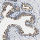 Immunohistochemical staining of human Prostate shows moderate membranous positivity in glandular cells.