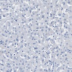 Anti-SLC6A6 Antibody