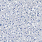 Immunohistochemical staining of human Liver shows no positivity in hepatocytes as expected.