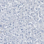 Immunohistochemical staining of human Liver shows no positivity in hepatocytes as expected.