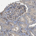 Immunohistochemical staining of human kidney shows moderate to strong cytoplasmic positivity in cells in glomeruli.
