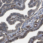 Immunohistochemical staining of human fallopian tube shows strong membranous positivity in endothelial cells.