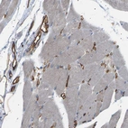 Immunohistochemical staining of human skeletal muscle shows strong membranous positivity in endothelial cells.