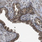 Immunohistochemical staining of human Prostate shows moderate membranous positivity in glandular cells.