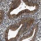 Immunohistochemical staining of human Endometrium shows moderate membranous positivity in glandular cells.