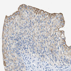 Anti-BPGM Antibody